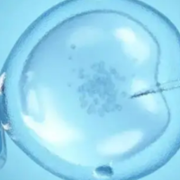 女性卵巢内有7个基础卵泡可用什么试管促排方案？