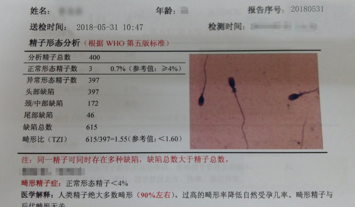 精子畸形率高影响受孕