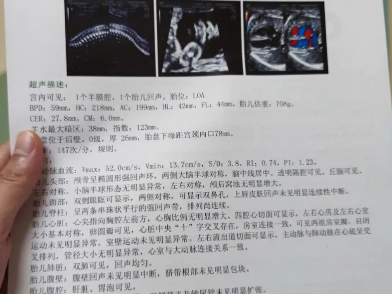 孕24周四维彩超报告