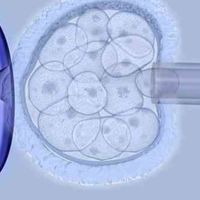 试管3CB和4BB囊胚的区别，质量和最终成功率都不同