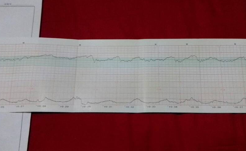 怀孕30周胎心检查报告