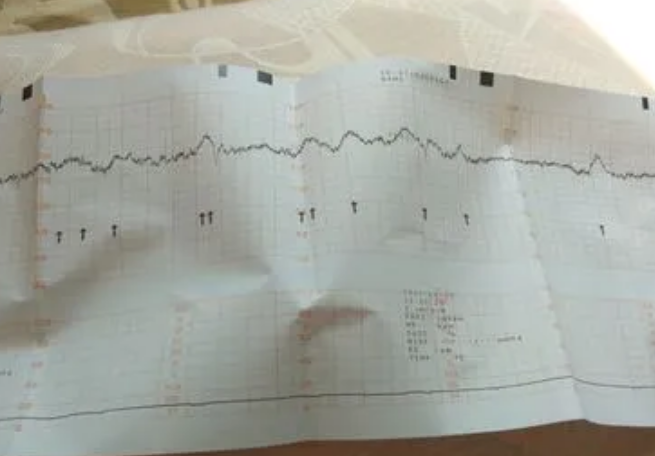 孕30周胎心率每分钟150以上胎儿是男孩概率高还是女孩几率大？