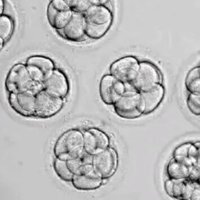 三代试管五天的6ab和5ab的囊胚可以同时移入吗？