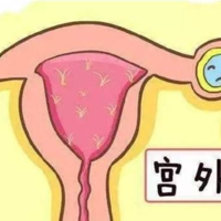 上一篇