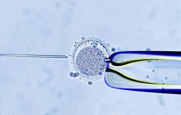 空卵泡主要与女性的卵巢功能有关