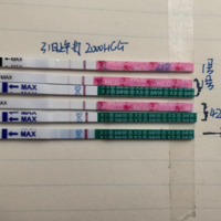 打hcg2000单位过48小时测早孕的结果真的准吗?