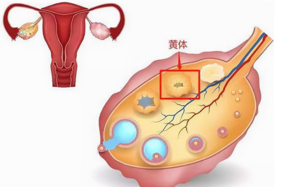 黄体破裂影响生育吗？黄体破裂详细介绍