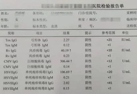 torch检查是孕前检查的一种