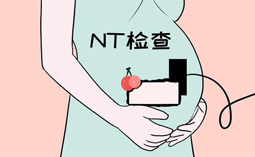 nt检查和智力没有关系