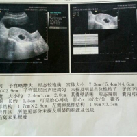 上一篇