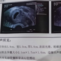 上一篇