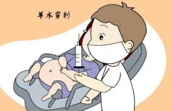 羊膜穿刺术用于观察婴儿是否染色异常