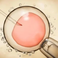第一代试管婴儿移植1PN囊胚其风险高不高？