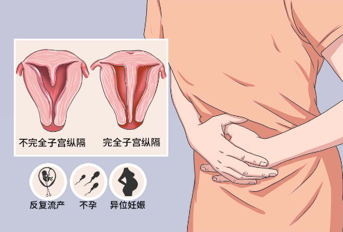 纵膈子宫患者不容易怀孕