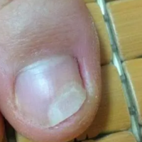下一篇