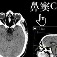 下一篇