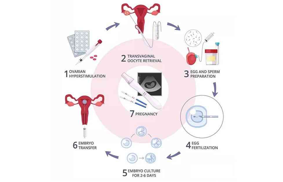 试管婴儿的具体步骤，试管婴需要做哪些事情