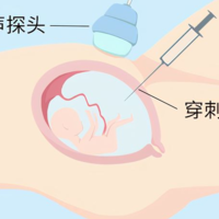 哪些疾病通过羊水穿刺检查仍不能排除？