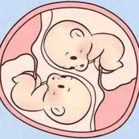 女性体重110斤偏胖能做三代试管移植双胞胎吗？