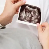 怀孕一个月最准看男女方法，孕囊圆的都生了女儿