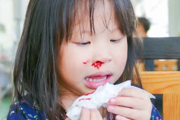 小孩鼻子出血可能是鼻腔干燥引起