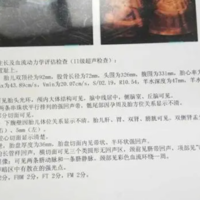 上一篇