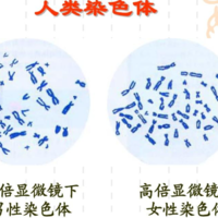 正常的女性染色体报告单图片，女性染色体异常表现！