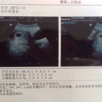 下一篇
