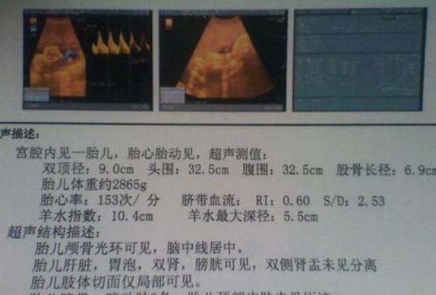 男宝宝的大腿骨长度通常会比女宝宝长一些