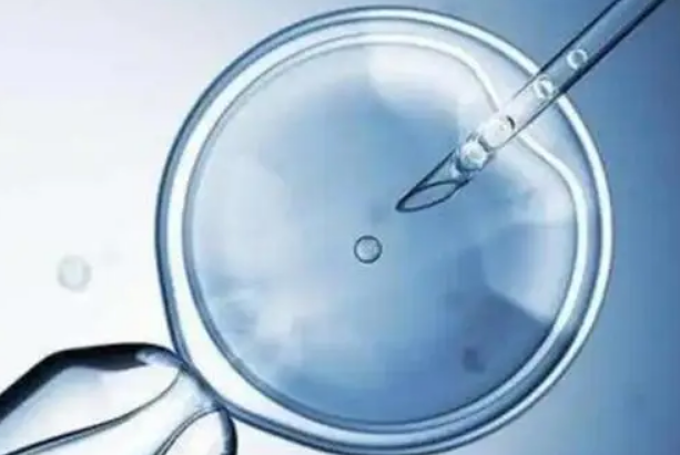 单囊胚移植可以降低多胎妊娠风险