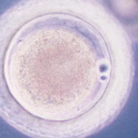 3代试管移植囊胚未着床还能继续移植吗？