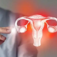 高龄试管打进口促排卵针为什么卵巢会变囊肿？