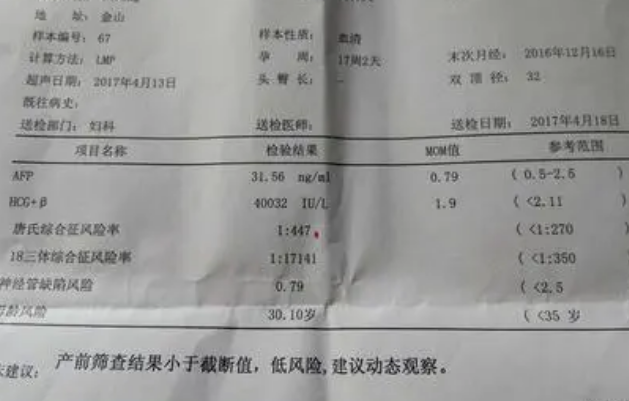 有人说唐筛单子上有暗示胎儿是男是女的地方在哪里？
