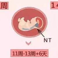 产检nt值高超过3mm一般与孕妇情绪有很大关系吗？