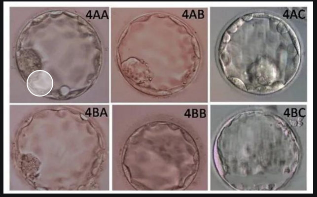 4bb囊胚不是最优质的胚胎