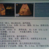 孕九周B超单上暗示男女的特征，孕囊的形状可以辨别