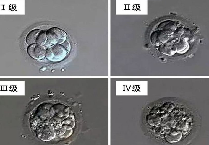 C等级的胚胎可以做试管移植