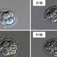 试管胚胎级别对照一览表，看图教你怎么划分8个三级
