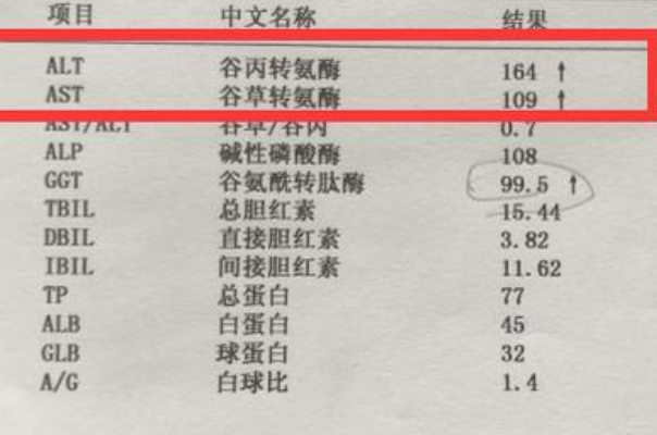 转氨酶140多一般不算特别严重