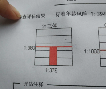 21三体是按比值来划分的