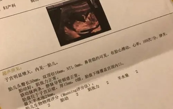 怀了男宝报告单上不会出现特点