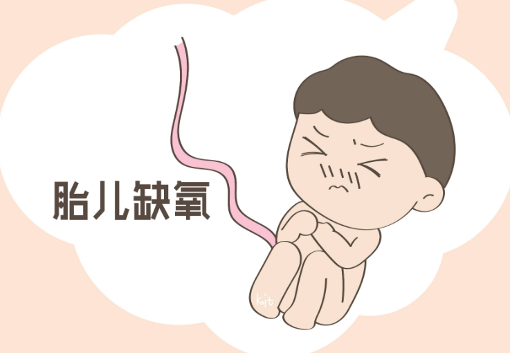 产程过长胎儿会缺氧