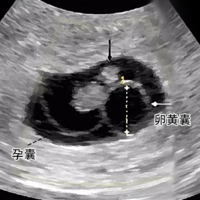 下一篇