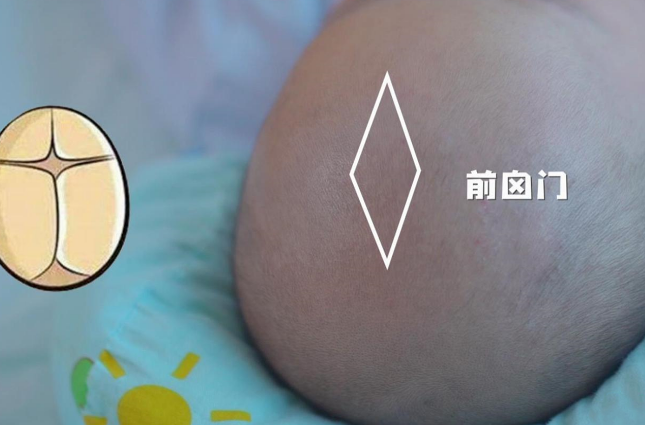囟门的存在可以减轻头部的压力