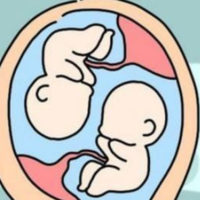 双胞胎宝宝一动一静怀的一定是龙凤双胎吗？