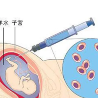 孕妈羊水穿刺做了后办公室坐着上班可以吗？