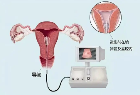 医生操作不当会导致插管疼痛