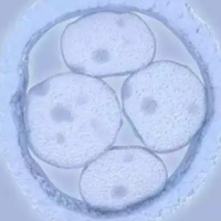 试管移植6BB胚胎聪明还是选择5BB的更聪明呢？