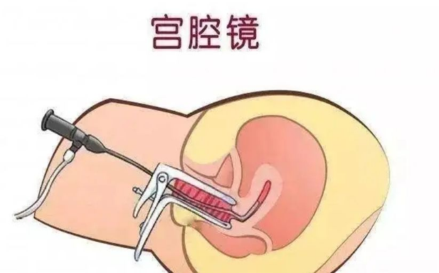 刚刚做了宫腔镜手术，多久可以正常备孕要宝宝