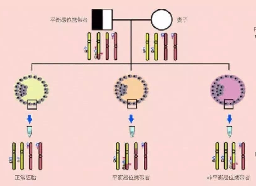 染色体平衡易位中易点在哪个位置最严重